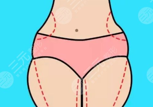 如何有效減肥不反彈？