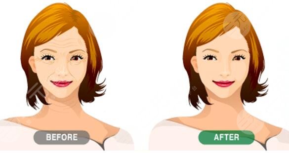 影響全面部懸吊術(shù)的價(jià)格因素有哪些?