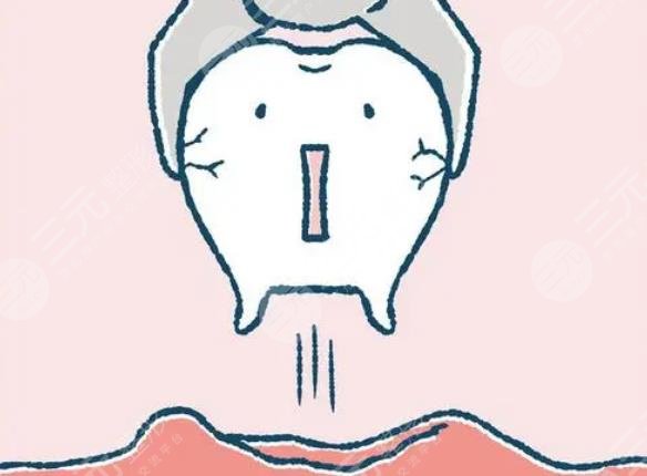 拔牙幾天才能恢?復(fù)正常?