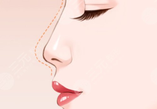 金柱翰做鼻子怎么樣