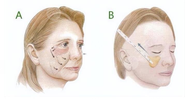 北京協(xié)和醫(yī)院整形外科擅長(zhǎng)項(xiàng)目