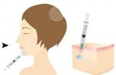 濡白天使固定下巴輪廓能保持多久?價格區(qū)間大概怎么樣？看看你適不適合這個項目！