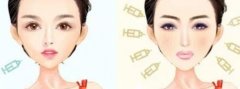 濡白天使針和豐顏哪個好？注射效果、價格和安全性都有區(qū)別！