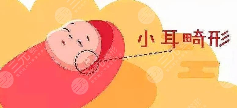 小耳畸形