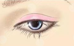 雙眼皮割多寬合適？了解一下全切雙眼皮手術(shù)的費(fèi)用、危害等知識(shí)！