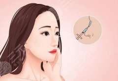 玻尿酸隆鼻貴嗎？費(fèi)用、維持時(shí)間以及可能的危害分享給你！