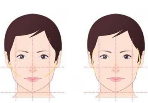 面部輪廓固定需要多少錢？