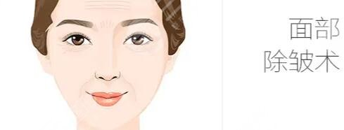 多大年齡適合做拉皮手術?