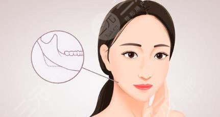 沈陽杏林磨骨怎么樣