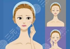 光子嫩膚一到七天圖分享！光子嫩膚案例、價(jià)格、原理分享！