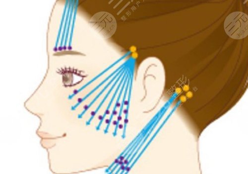 做完線雕多久可以恢復(fù)？