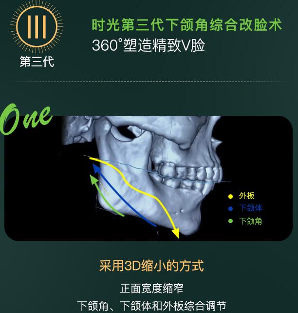 杭州時(shí)光醫(yī)療美容醫(yī)院是三甲嗎，技術(shù)怎么樣？測評報(bào)告&價(jià)格一覽！