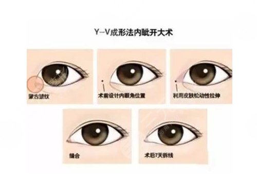 北京愛悅麗格醫(yī)療美容診所怎么樣