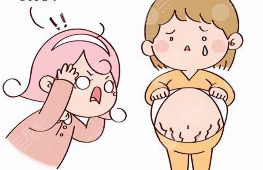 妊娠紋怎么消除