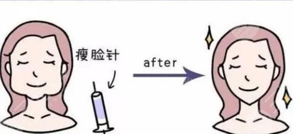 注射瘦臉