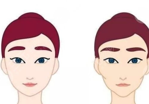 輪廓手術(shù)危險嗎？