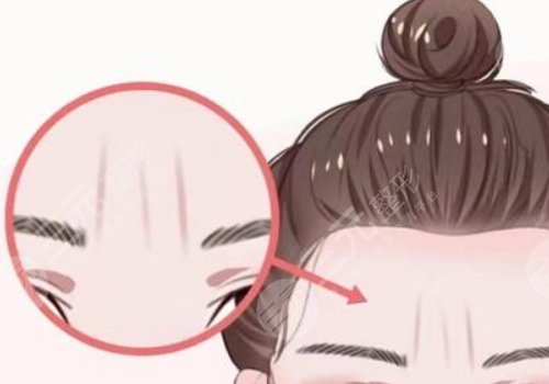 骨相抗衰原理是什么？