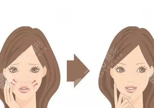 骨相抗衰原理是什么？