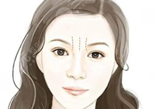 骨相抗衰原理是什么？