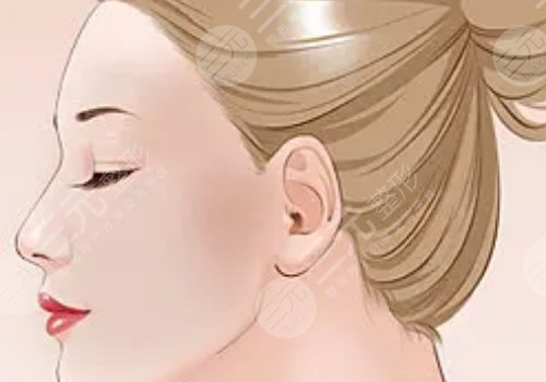 骨相抗衰和皮相抗衰的區(qū)別