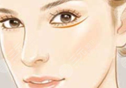 注射伊妍仕腫一個多月正常嗎？