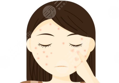 痘印怎么消除？