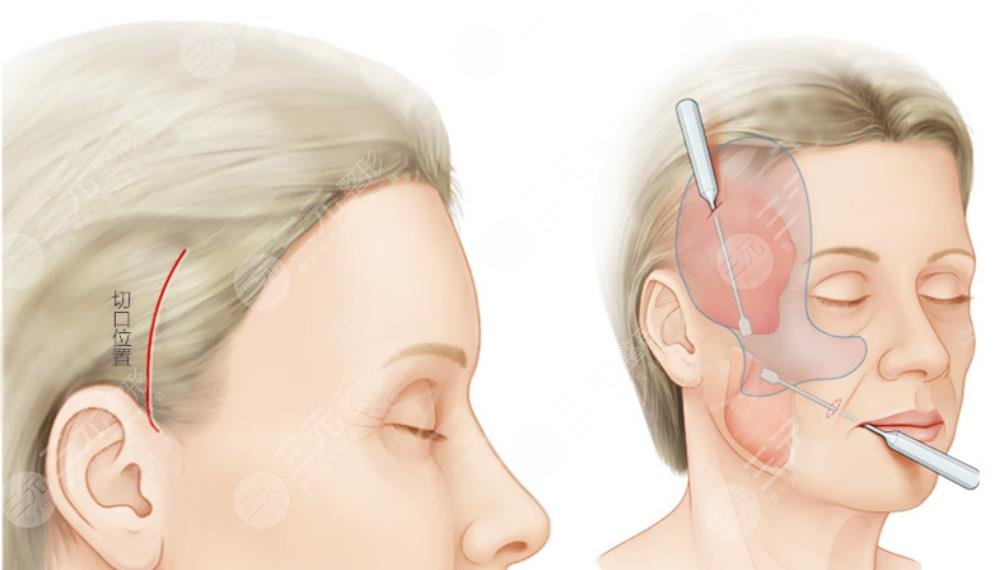 中國醫(yī)大一院擅長項(xiàng)目科普