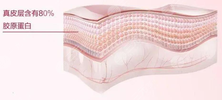 madm膠原蛋白支架