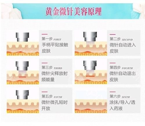 如何祛除臉上的疤痕?