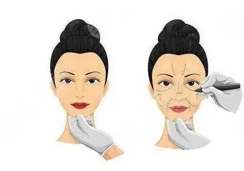 骨相抗衰怎么做？