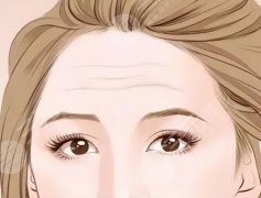 做小拉皮手術(shù)能夠維持幾年？不同類型維持時(shí)間不同、術(shù)后注意事項(xiàng)一覽