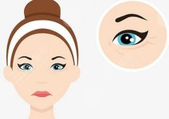 做眼部拉皮手術(shù)好不好？眼部拉皮手術(shù)的流程簡(jiǎn)介~注意事項(xiàng)分享