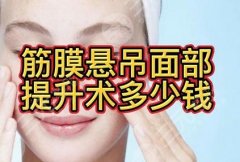 筋膜懸吊面部提升術(shù)價(jià)格多少？?jī)r(jià)格相對(duì)適合很多人~手術(shù)簡(jiǎn)介