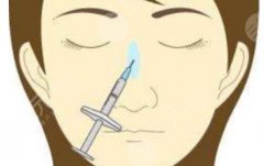 濡白天使1支夠打鼻子嗎？濡白天使和其他玻尿酸的區(qū)別介紹！