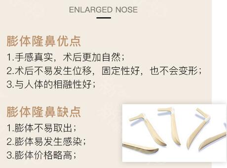 膨體隆鼻恢復(fù)時間多久？科普小課堂！深度了解優(yōu)缺點(diǎn)、價格~