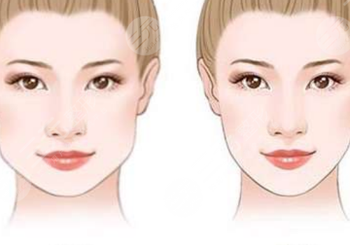 咬肌大怎么瘦下來