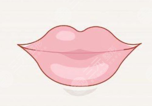 微笑唇打玻尿酸能保持多久？