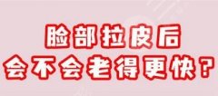 做拉皮會(huì)老的更快嗎？拉皮手術(shù)有助于保持皮膚年輕狀態(tài)~一起了解