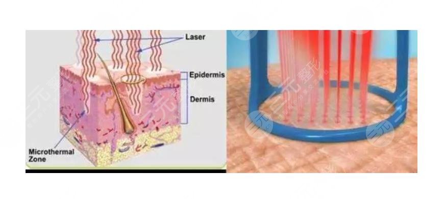 廣東高尚醫(yī)療美容門診部擅長項目科普