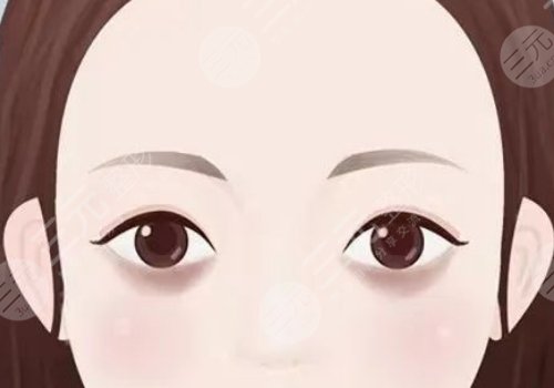 去黑眼圈和眼袋有效的方法是什么？眼周抗衰指南！