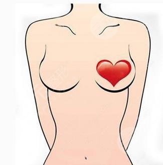 陳萬芳脂肪豐胸案例