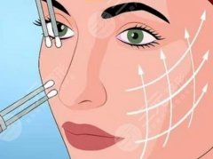 迷你小拉皮能挺多長(zhǎng)時(shí)間？一般3-5年，注意護(hù)理延長(zhǎng)保持效果~