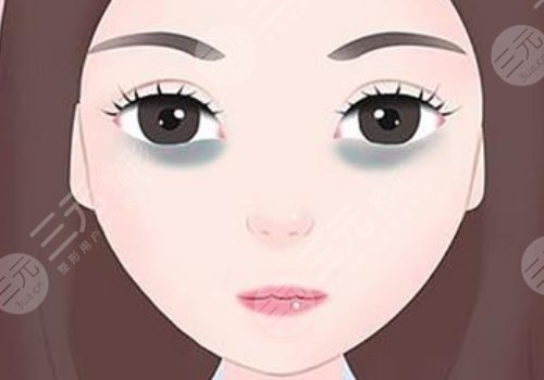 去黑眼圈手術(shù)多少錢啊？