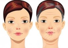 小拉皮手術(shù)效果好嗎？小拉皮手術(shù)相關(guān)知識(shí)科普來(lái)了、一起了解