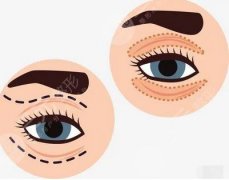 正規(guī)醫(yī)院割雙眼皮大概多少錢？不同手術(shù)形式和操作需求價(jià)格有差別