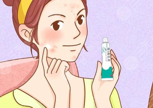 臉頰兩側(cè)長(zhǎng)痘痘什么原因