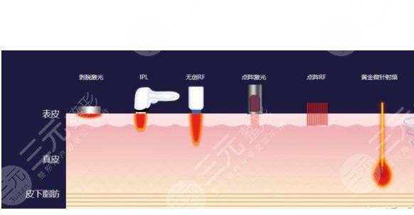 去黑眼圈和眼袋有效的方法是什么？眼周抗衰指南！