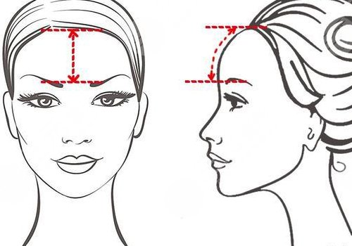 中庭太長怎么改良？