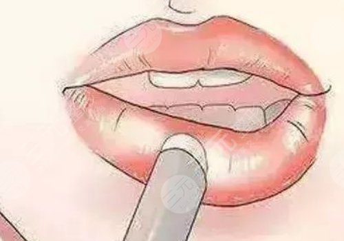 唇部老化的原因有哪些？唇部老化如何改良？