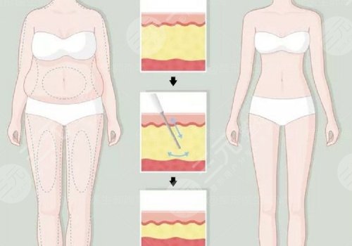 身體塑形能達到減肥的效果嗎？